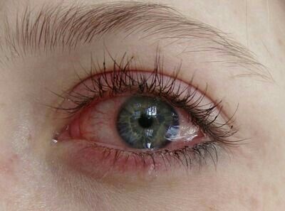 عيون حزينة 3 1